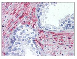 Immunohistochemical analysis of CGK2 expression in formalin fixed, paraffin embedded Human prostate section, using ab110124 at 10 µg/ml.