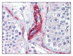Immunohistochemical analysis of CGK2 expression in formalin fixed, paraffin embedded Human testis section, using ab110124 at 10 µg/ml.