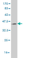 Western blot against tagged recombinant protein immunogen using ab57437 cGKI antibody at 1ug/ml.