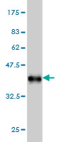 Western blot against tagged recombinant protein immunogen using ab57439 cGKI antibody at 1ug/ml.