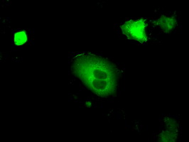 ab119000 at 1/100 dilution staining cGKI in COS7 cells transiently transfected by pCMV6-ENTRY cGKI by Immunofluorescence.