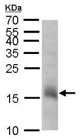 Anti-CHAC2 antibody (ab183852) at 1/1000 dilution + Human ESC whole cell lysate at 30 µg