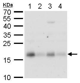 All lanes : Anti-CHAC2 antibody (ab183852) at 1/500 dilutionLane 1 : 293T whole cell lysateLane 2 : A431 whole cell lysateLane 3 : HeLa whole cell lysateLane 4 : HepG2 whole cell lysateLysates/proteins at 30 µg per lane.