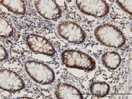 CHD3 antibody (ab54602) used in immunohistochemistry at 3ug/ml on formalin fixed and paraffin embedded human colon.