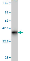 Western blot against tagged recombinant protein immunogen using ab54602 CHD3 antibody at 1ug/ml.