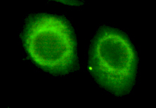 Immunofluorescent analysis of HeLa cells labeling CHD3 with ab151263 at 1/150 dilution.