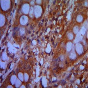 Immunohistochemical analysis of paraffin-embedded Human colon tissue labeling CHD3 with ab151263 at 1/500 dilution.