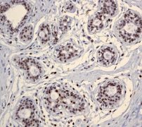 Immunohistochemical staining of paraffin-embedded Human breast tissue using ab109195 at a dilution of 1/100.