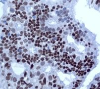 Immunohistochemical staining of paraffin-embedded Human ovary tissue using ab109195 at a dilution of 1/100.