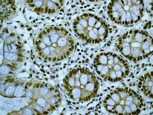 Immunohistochemical analysis of paraffin embedded Human colon tissue labelling CHD3 with ab133623 antibody at a dilution of 1/250.