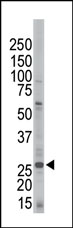Anti-14-3-3 zeta antibody (ab37560) at 1/100 dilution + Jurkat cell lysate
