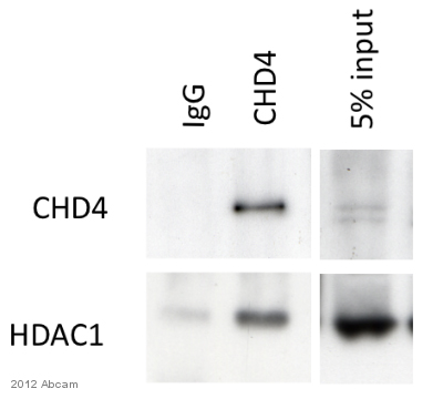 CHD4 immunoprecipitation from murine brain tissue lysate using ab70469. 5000 µg of cell lysate was incubated with primary antibody (undiluted) and matrix (protein G) and incubated for 14 hours. An HRP-conjugated rabbit anti-CHD4 polyclonal (1/1000) was used to detect CHD4 immunoprecipitation.See Abreview