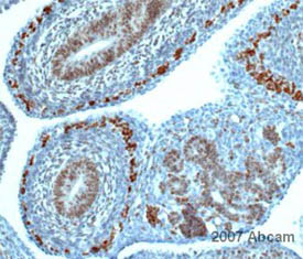 ab31824 at 1/500 staining mouse embryo tissue sections by Immunohistochemistry (Formalin/PFA-fixed paraffin-embedded sections). The tissue sections were formaldehyde fixed and a heat mediated antigen retrieval step was performed prior to incubation with the antibody for 20 minutes. An HRP conjugated donkey anti-rabbit antibody was used as the secondary.See Abreview