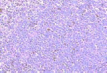 Immunohistochemistry on paraffin section of human spleen, at 1/250 dilution.