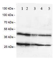 All lanes : Anti-Chemokine Receptor D6 antibody (ab125224) at 1 µg/mlLane 1 : HeLa whole cell lysateLane 2 : SW620 whole cell lysateLane 3 : A549 whole cell lysateLane 4 : MM231 whole cell lysateLane 5 : SMMC whole cell lysate