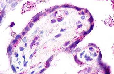 Immunohistochemical analysis of paraffin-embedded Human placenta tissue labelling Chemokine Receptor D6 with ab140797 at 24 µg/ml.