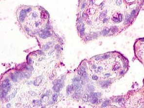 Immunohistochemical analysis of paraffin-embedded Human placenta tissue labelling Chemokine Receptor D6 with ab140794 at 20 µg/ml (after heat-induced antigen retrieval)