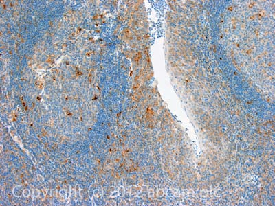 IHC image of CHI3L1 staining in Human normal tonsil formalin fixed paraffin embedded tissue section, performed on a Leica BondTM system using the standard protocol F. The section was pre-treated using heat mediated antigen retrieval with sodium citrate buffer (pH6, epitope retrieval solution 1) for 20 mins. The section was then incubated with ab86428, 5µg/ml, for 15 mins at room temperature and detected using an HRP conjugated compact polymer system. DAB was used as the chromogen. The section was then counterstained with haematoxylin and mounted with DPX.For other IHC staining systems (automated and non-automated) customers should optimize variable parameters such as antigen retrieval conditions, primary antibody concentration and antibody incubation times.