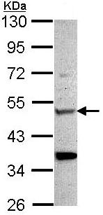 Anti-CHIT1 antibody (ab96045) at 1/1000 dilution + HeLa whole cell lysate at 30 µg