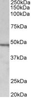 Anti-CHIT1 antibody (ab126866) at 1 µg/ml + Daudi lysate at 35 µgdeveloped using the ECL technique