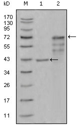 All lanes : Anti-CHIT1 antibody [1D9G2,1D9G4,2B4G3] (ab81613) at 1/500 dilutionLane 1 : truncated Trx-CHIT1 recombinant protein Lane 2 : truncated CHIT1 (aa22-466)-hIgGFc transfected CHO-K1 cell lysate