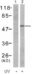 All lanes : Anti-Chk1 (phospho S280) antibody (ab47560) at 1/500 dilutionLane 1 : HT29 cells, untreated Lane 2 : HT29 cells treated with UV