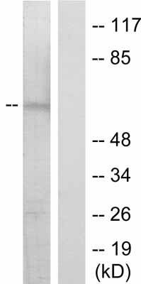All lanes : Anti-Chk2 (phospho S516) antibody (ab36724) at 1/500 dilutionLane 1 : Hela cell extract treated with UV Lane 2 : Hela cell extract untreatedLysates/proteins at 30 µg per lane.
