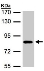 Anti-Chloride Channel 5 antibody (ab97482) at 1/500 dilution + A431 whole cell lysate at 30 µg