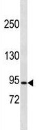 Anti-Chloride Channel 5 antibody - N-terminal (ab156155) at 1/100 dilution + K562 cell line lysate at 35 µg