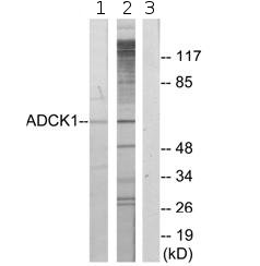 All lanes : Anti-ADCK1 antibody (ab72760) at 1/500 dilutionLane 1 : Extracts from A549 cellsLane 2 : Extracts from RAW264.7 cellsLane 3 : Extracts from A549 cells with immunising peptide at 5 µgLysates/proteins at 5 µg per lane.