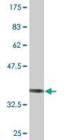 Anti-CHODL antibody (ab76710) at 5 µg + immunogen at 0.2 µgSecondaryGoat Anti-Mouse IgG (H&L)-HRP Conjugate at 1/5000 dilution