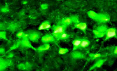Immunohistochemical detection of ChAT in rat basal forebrain using Sheep anti ChAT (ab18736).Rat was perfused with 1% sodium Nitrite in 0.1M TBS, pH, 7.4 for 20 min. and then fixed with 4% formaldehyde containing 15% picric acid in 0.1M TBS, pH, 7.4 for 30 min. The brain was then cryoprotected in 30% overnight and cut into 40 nm free-floating sections. Sections were washed 2x with TBS for 20 min. and passed through asending ethanol and finally transferred to 0.1 M TBS for rehydration for 1h.