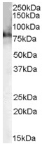 Anti-Choline Acetyltransferase antibody (ab50412) at 0.2 µg/ml + Mouse Brain lysate (35µg protein in RIPA buffer).