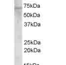 Anti-Choline Acetyltransferase antibody (ab27484) at 0.03 µg/ml + Human placenta lysate at 35 µg