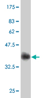 Western blot against tagged recombinant protein immunogen using ab54599 Choline Acetyltransferase antibody at 1ug/ml.
