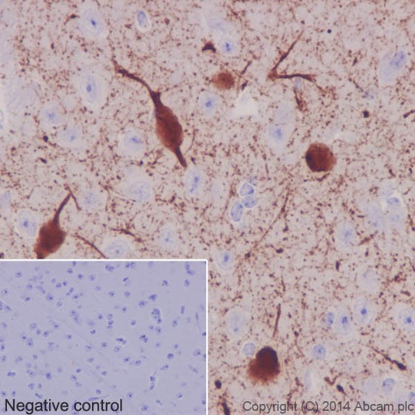 Immunohistochemical analysis of paraffin-embedded Guinea Pig cerebral cortex tissue labeling Choline Acetyltransferase with ab178850 at 1/2000 followed by prediluted HRP Polymer for Rabbit/Mouse IgG. Nucleus and cytoplasm staining on neurons of Guinea Pig cerebral cortex is observed. Counter stained with Hematoxylin.Negative control: Using PBS instead of primary ab, secondary ab is prediluted HRP Polymer for Rabbit/Mouse IgG.