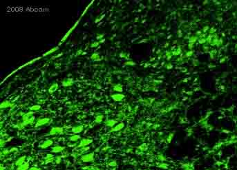 ab6168 staining cells in rat brain section by ICC/IF. Cells were PFA fixed and blocked in 10% serum for 1 hour at 25°C. The primary antibody was diluted 1/200 in 10% donkey serum and incubated with the sample for 24 hours at 25°C. A FITC-conjugated donkey polyclonal to rabbit IgG, diluted 1/200 was used the secondary.See Abreview