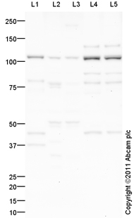 All lanes : Anti-Chordin antibody (ab101316) at 1 µg/mlLane 1 : Brain (Human) Tissue Lysate - adult normal tissue (ab29466)Lane 2 : Liver (Mouse) Tissue LysateLane 3 : Liver (Rat) Tissue LysateLane 4 : Brain (Mouse) Tissue LysateLane 5 : Brain (Rat) Tissue Lysate Lysates/proteins at 20 µg per lane.SecondaryGoat Anti-Rabbit IgG H&L (HRP) preadsorbed (ab97080) at 1/5000 dilutiondeveloped using the ECL techniquePerformed under reducing conditions.