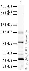 Anti-Chp1 antibody - ChIP Grade (ab18191) at 1 µg/ml + S.pombe Whole Cell Lysate at 20 µgSecondaryGoat polyclonal to Rabbit IgG - H&L - Pre-Adsorbed (HRP) at 1/10000 dilutionPerformed under reducing conditions.