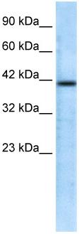 Anti-CHRFAM7A antibody (ab28885) at 0.5 µg/ml + Jurkat cell lysateSecondaryHRP conjugated anti-Rabbit IgG (suggested dilution 1:50000 - 100000)developed using the ECL technique