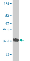 Western blot against tagged recombinant protein immunogen using ab54622 Acetylcholine Receptor Protein delta Precursor antibody at 1ug/ml.