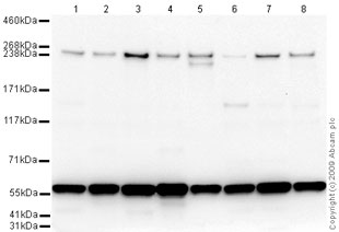 All lanes : Anti-Chromodomain helicase DNA binding protein 5 antibody (ab66516) at 1 µg/mlLane 1 : TE 671 (Human Rhabdomyosarcoma) Whole Cell LysateLane 2 : Hela Whole Cell Lysate - Hydroxyurea Treated (48hr, 2uM)Lane 3 : HepG2 (Human hepatocellular liver carcinoma cell line) Whole Cell LysateLane 4 : Hela Whole Cell Lysate - Bleomycin Treated (20U/ml)Lane 5 : Liver (Human) Tissue Lysate - adult normal tissue (ab29889)Lane 6 : Jurkat (Human T cell lymphoblast-like cell line) Whole Cell LysateLane 7 : HeLa (Human epithelial carcinoma cell line) Whole Cell LysateLane 8 : JEG-3 (Human placental choriocarcinoma cell line) Whole Cell LysateLysates/proteins at 10 µg per lane.SecondaryGoat polyclonal to Rabbit IgG - H&L - Pre-Adsorbed (HRP) at 1/3000 dilutionPerformed under reducing conditions.
