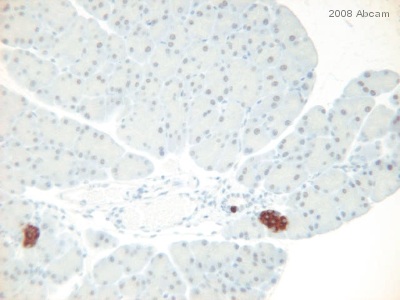 ab15160 (1/100) staining Chromogranin A in paraffin-embbeded mouse pancreas tissue sections. Tissue underwent fixation in formaldehyde, heat-mediated antigen retrieval in citrate buffer pH 6.0 and blocking (10 minutes, 1.5% serum). An HRP-conjugated goat polyclonal was used as the secondary. For further experimental details please refer to abreview.See Abreview