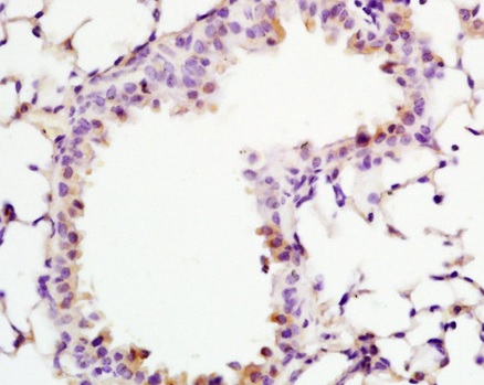 Immunohistochemistry on Formalin/PFA-fixed paraffin-embedded rat lung tissue labeling ADCY10 with ab203204 at a 1/200 dilution, followed by conjugation to the secondary antibody and DAB staining.