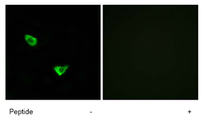 Immunofluorescence analysis of CHSS2 in MCF-7 cells, using ab75052 at a 1/500 dilution.Left image: untreated.Right image: treated with immunizing peptide.