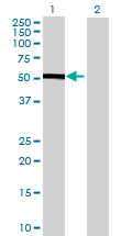 All lanes : Anti-CHST12 antibody (ab68734) at 1/500 dilutionLane 1 : CHST12 transfected 293T cell lysateLane 2 : Non transfected 293T cell lysateLysates/proteins at 25 µg per lane.SecondaryGoat Anti-Mouse IgG (H&L)-HRP conjugated at 1/2500 dilution