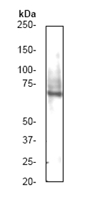 Anti-cIAP2 antibody [E40] (ab32059) at 1/1000 dilution + Daudi cell lysate.