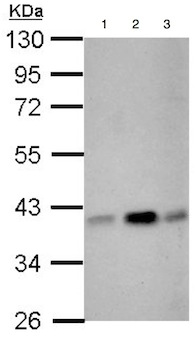 All lanes : Anti-CIAPIN1 antibody (ab154904) at 1/3000 dilutionLane 1 : NIH 3T3 whole cell lysateLane 2 : JC whole cell lysateLane 3 : BCL1 whole cell lysateLysates/proteins at 30 µg per lane.