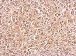 Immunohistochemical analysis of formalin-fixed, paraffin-embedded Human SkHep1 xenograft tissue labeling CIAPIN1 with ab154904 at 1/500 dilution.