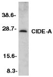 Anti-CIDE A antibody (ab8402) at 1/500 dilution + Murine heart tissue lysate